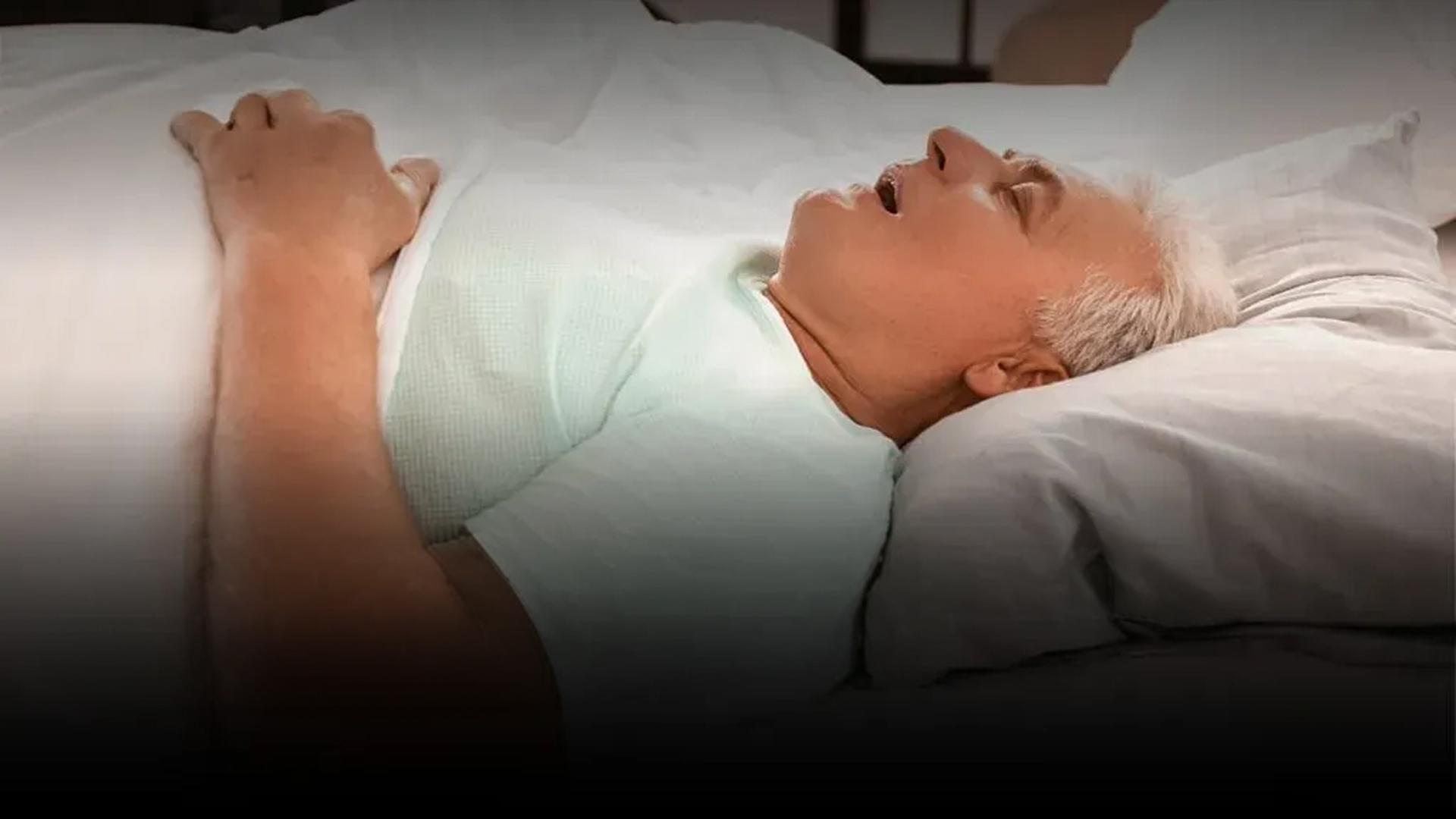 Mouth Breathing And Sleep Disorders In Children